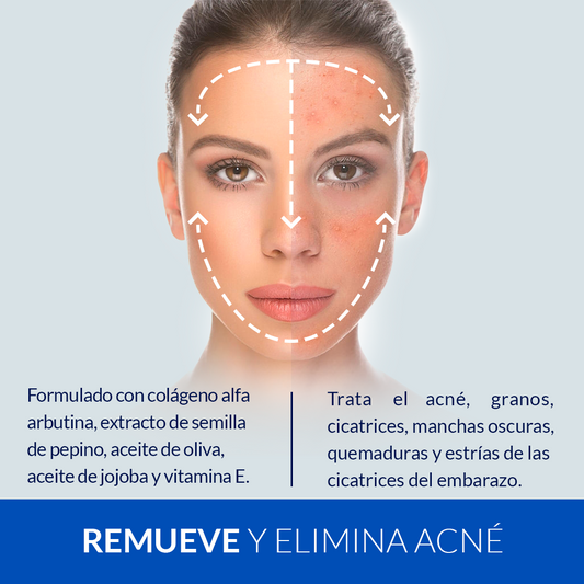 TONICO ANTI-ACNE AFRODITA